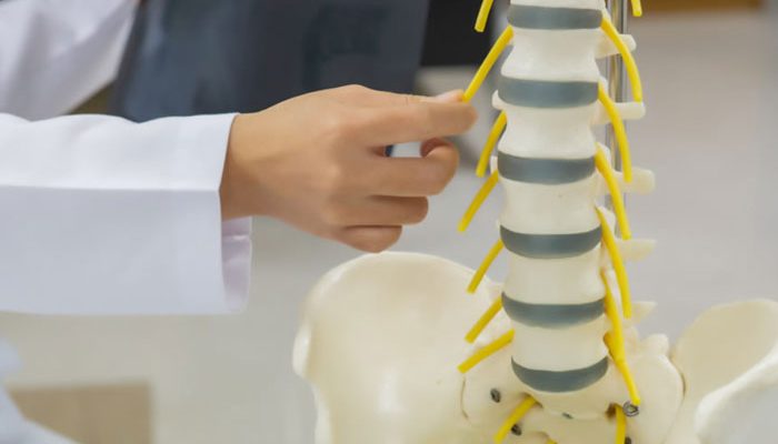 Degenerative Arthritis Of The Spine