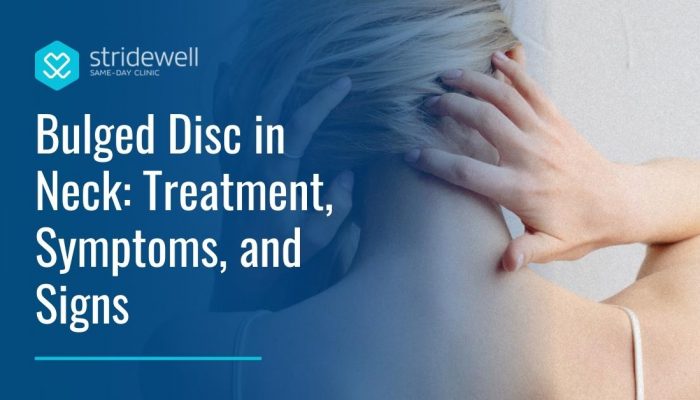 Bulged Disc in Neck: Treatment, Symptoms, and Signs
